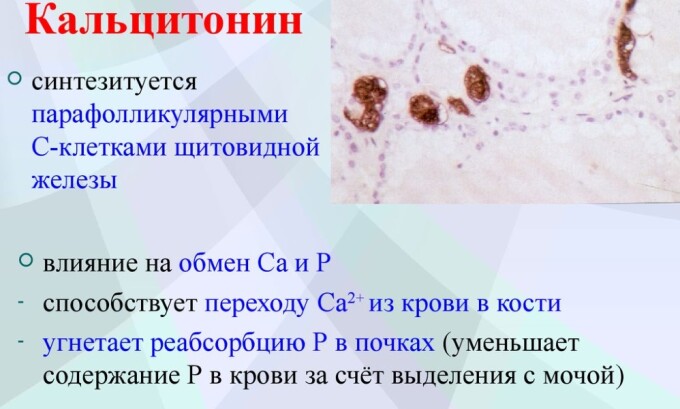 Повышение уровня показателя кальцитонина в крови свидетельствует о наличии онкологического заболевания щитовидной железы