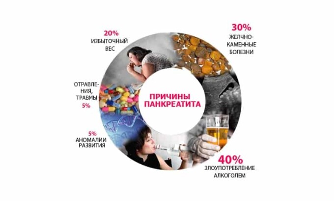 Панкреатит могут вызывать различные факторы
