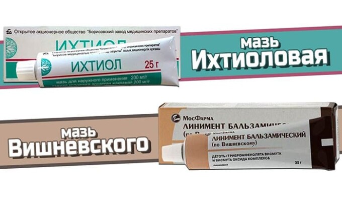 Наиболее распространённые мази, которые используют для лечения являются: мазь Вишневского, Ихтиоловая