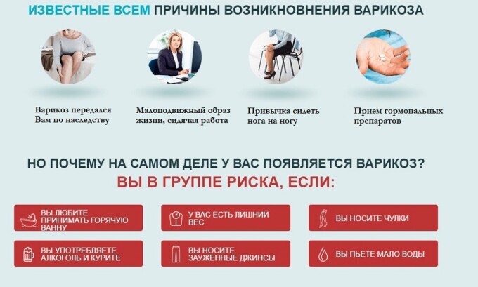 Причины возникновения варикоза