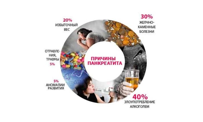 Причин панкреатита может быть несколько