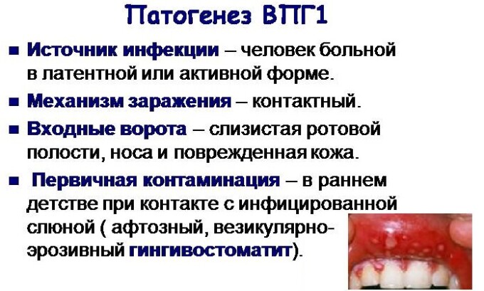 Типичный симптом инфекции ВПГ 1 - высыпание на губах, которое ещё называют 