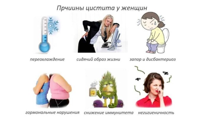 У женщин воспаление пузыря нередко наблюдается на фоне гинекологической патологии (кольпита, вульвита).
